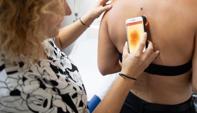 Félünk a bőrráktól, mégsem vesszük elég komolyan a megelőzést